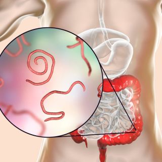 Eliminación Completa de Parásitos